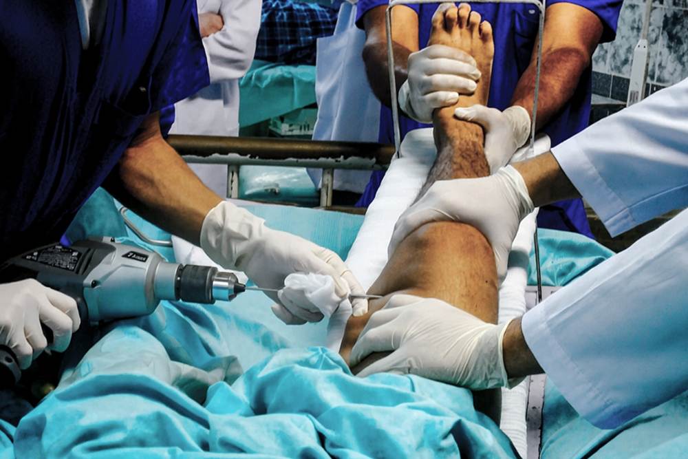 Complex Trauma Treatment Procedure | Dr. Soumen Kar