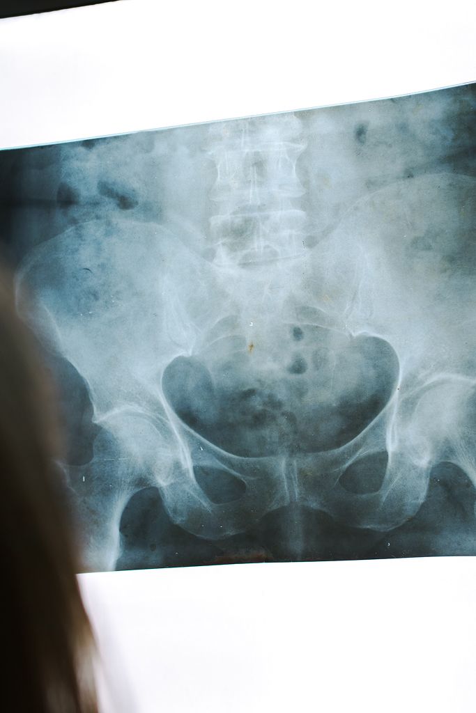 Pelvic Trauma Surgeon in Kolkata | Dr. Soumen Kar