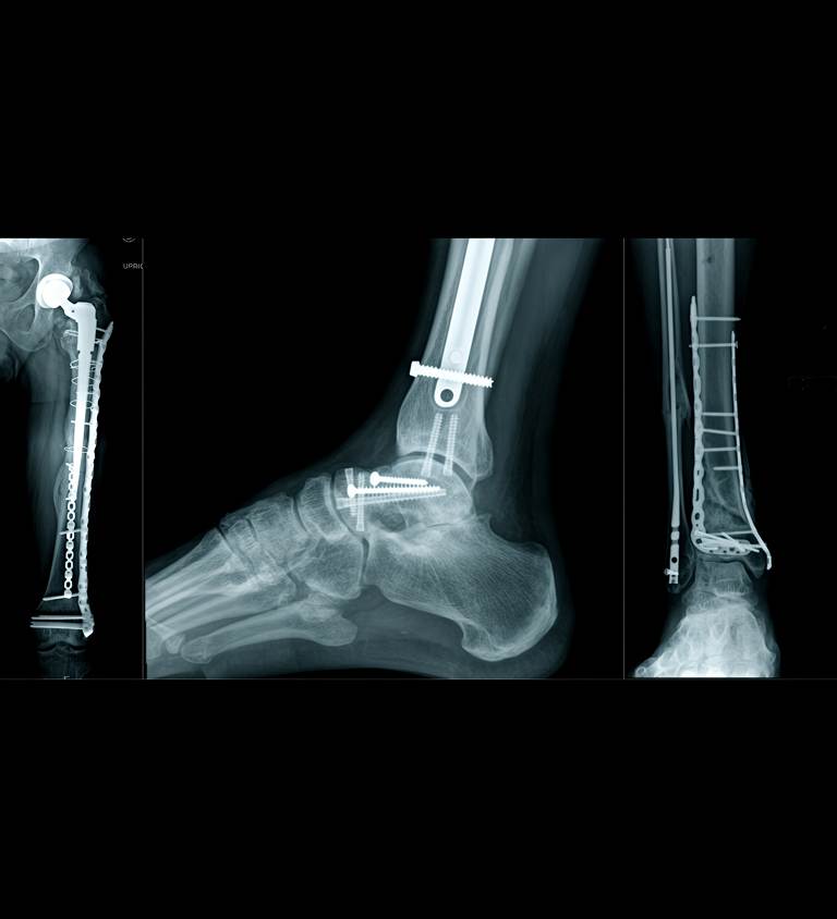 Types of Complex Trauma | Dr. Soumen Kar